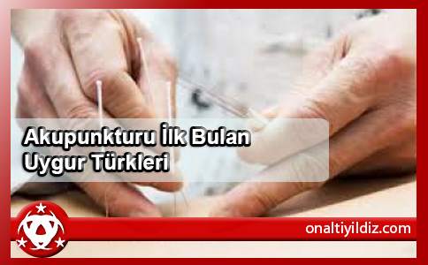 Akupunkturu İlk Bulan Uygur Türkleri