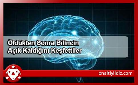 Öldükten Sonra Bilincin Açık Kaldığını Keşfettiler