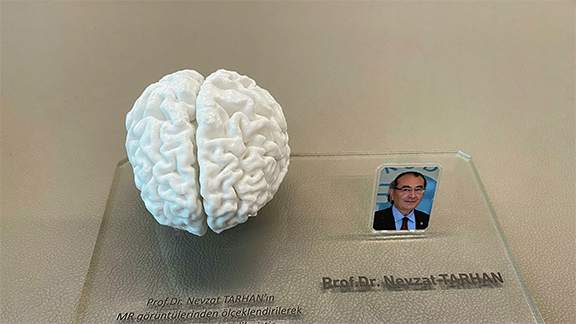 Türkiye'de İlk: 3D Yazıcı İle İnsan Beyninin Birebir Kopyası Yapıldı