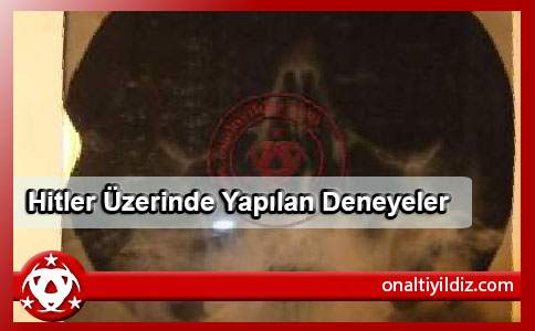 Hitler Üzerinde Yapılan Deneyeler