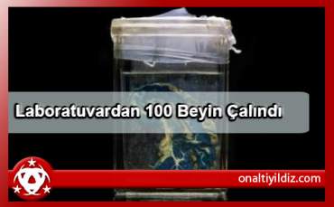 Laboratuvardan 100 Beyin Çalındı