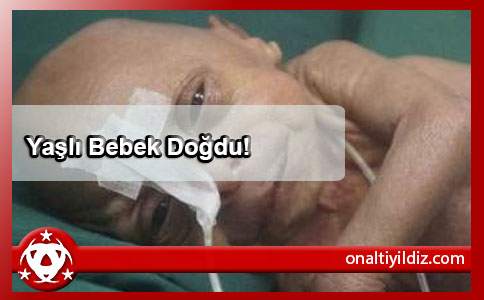 Yaşlı Bebek Doğdu!