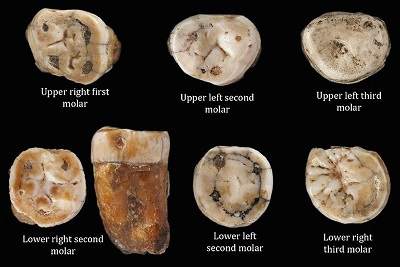 Bu Dişler, Modern İnsan-Neandertal Melezine Ait Çıktı
