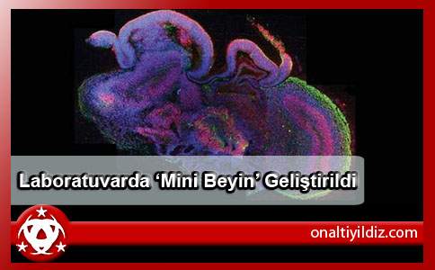 Laboratuvarda ‘Mini Beyin’ Geliştirildi