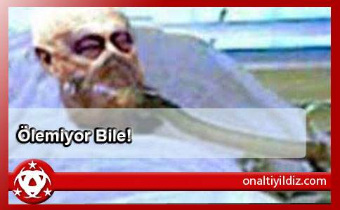 Ölemiyor Bile!